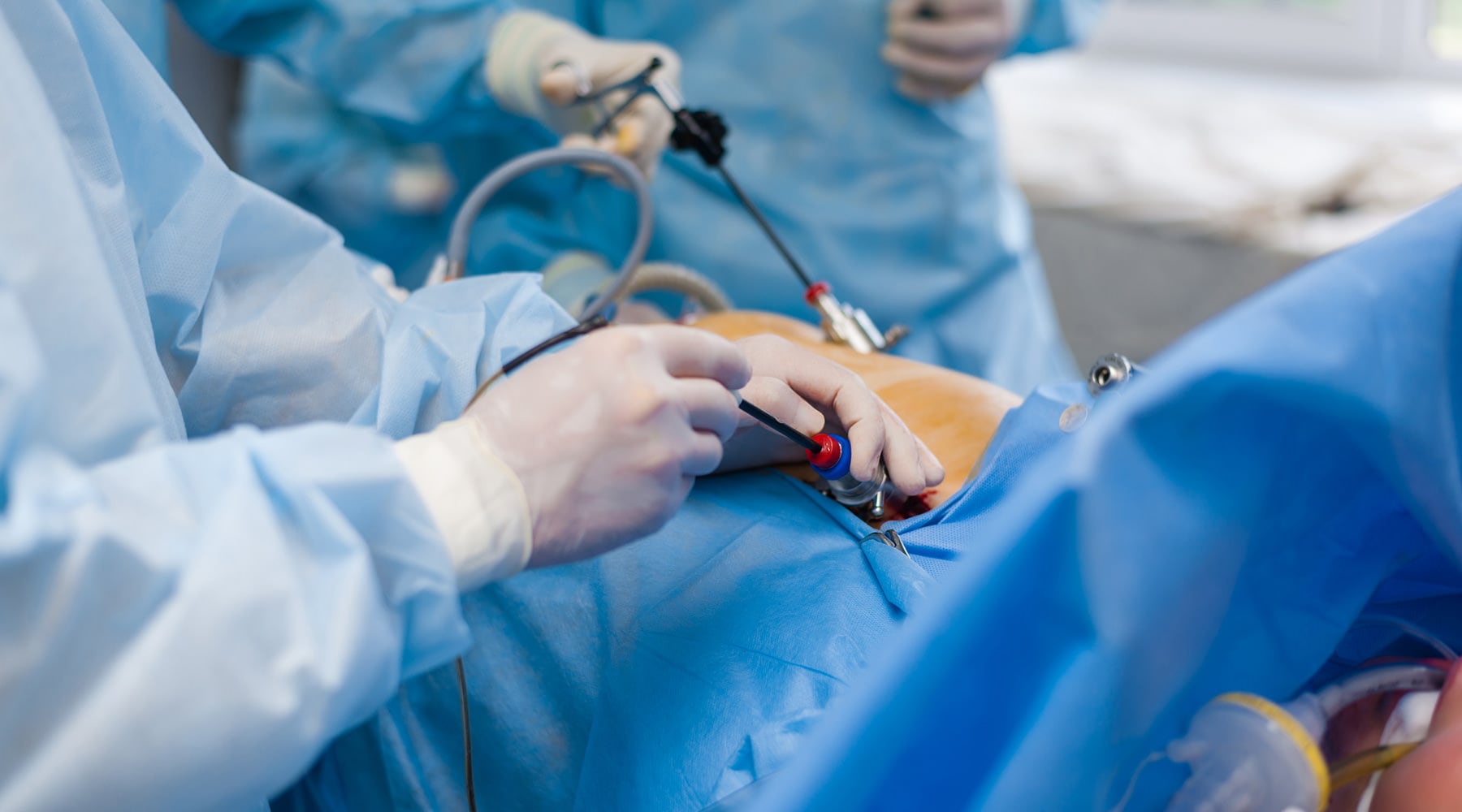 Expert Laparoscopic surgery in Dombivli 
